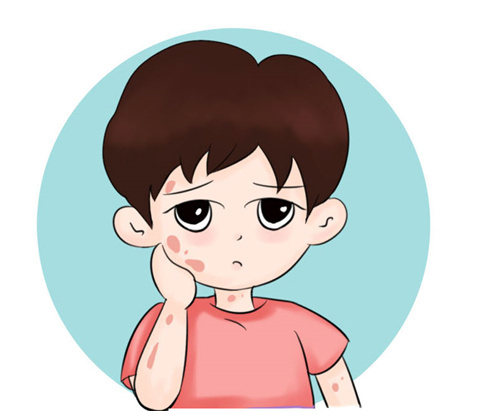 哪些药物治疗银屑病效果好