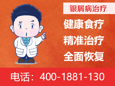 成都银康银屑病医院是专业治疗银屑病的吗