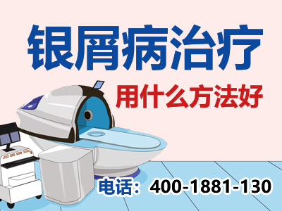 成都银康银屑病医院怎么样