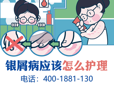 成都银康银屑病医院治的怎么样